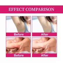 OUHOE Underarm Whitening Cream