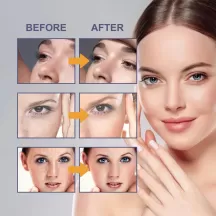 OUHOE Bright White Spot Removing Cream